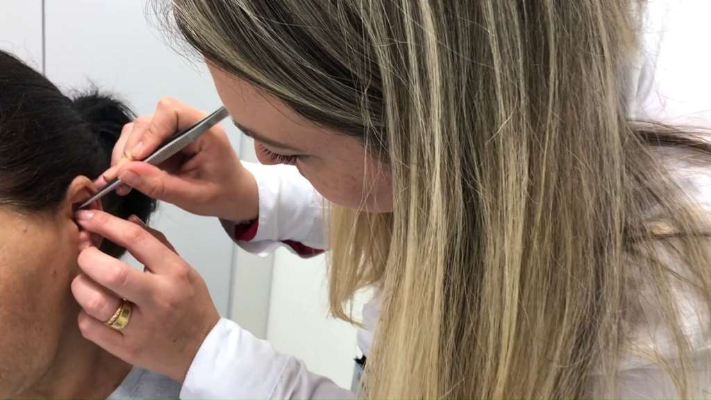 Auriculoterapia contribui no tratamento dos pacientes
