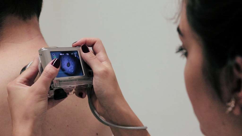 Saúde conta agora com teledermatologia para agilizar diagnóstico