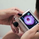 Saúde conta agora com teledermatologia para agilizar diagnóstico