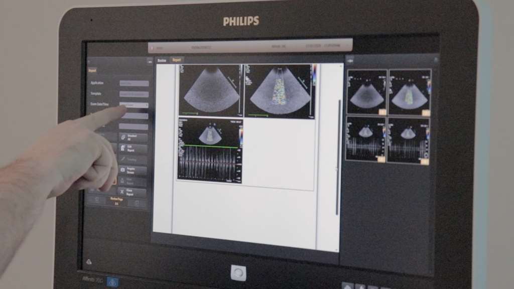 Saúde adquire novo aparelho de ultrassonografia