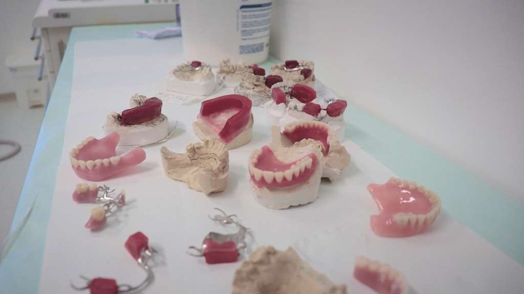 Saúde disponibiliza próteses dentárias aos pacientes