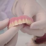 Saúde disponibiliza próteses dentárias aos pacientes